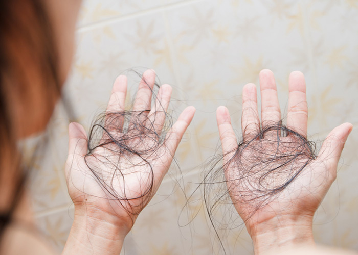 ریزش مو چیست؟ + علائم و علل ریزش مو