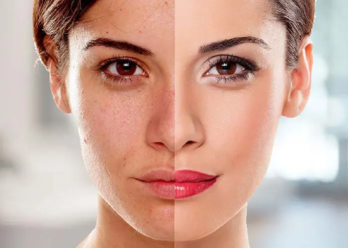 روشن شدن پوست : بهترین روش ها + روشن پوست صورت حساس