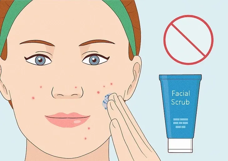 وقتی جوش های فعال دارید از اسکراب صورت استفاده نکنید