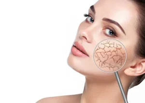 بهترین سرم روشن کننده برای پوست خشک