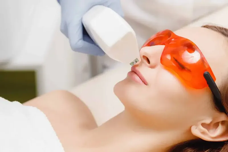 عوارض قرارگرفتن در مقابل آفتاب بعد از لیزر