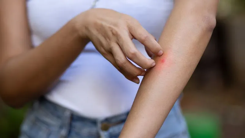 جوش روی دست