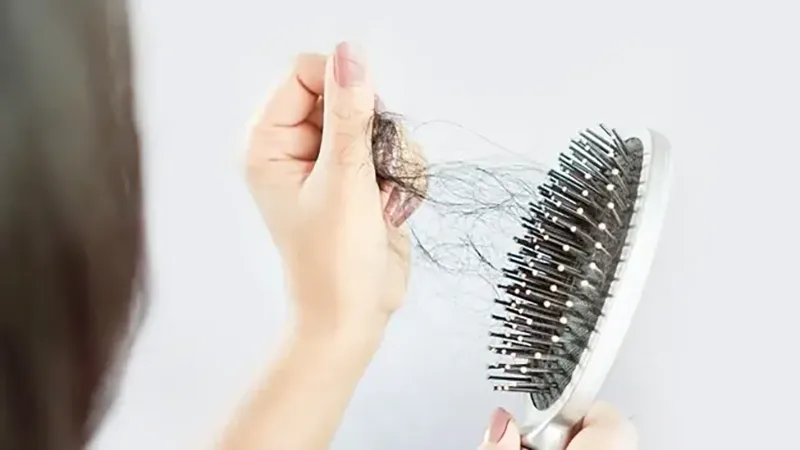 کدام ریزش مو برگشت پذیر است